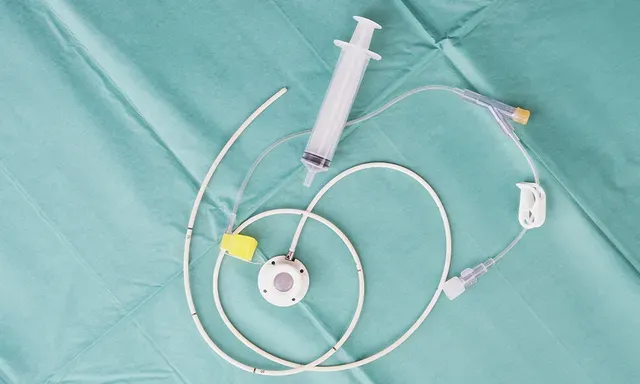 Portacath Placement