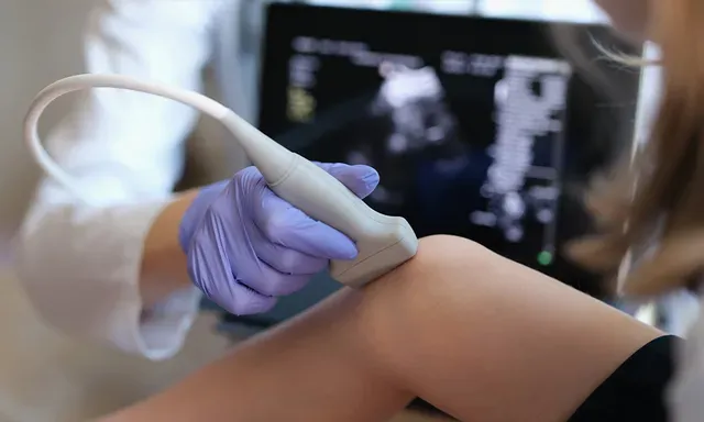Vascular Ultrasound Laboratory